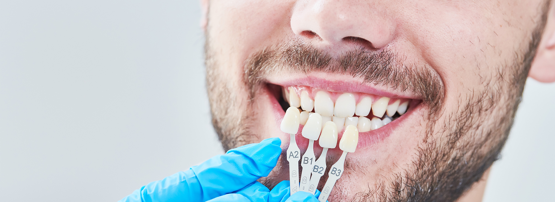 Plainfield Dental Care | iTero   Intraoral Scanner, Dental Fillings and Preventative Dentistry