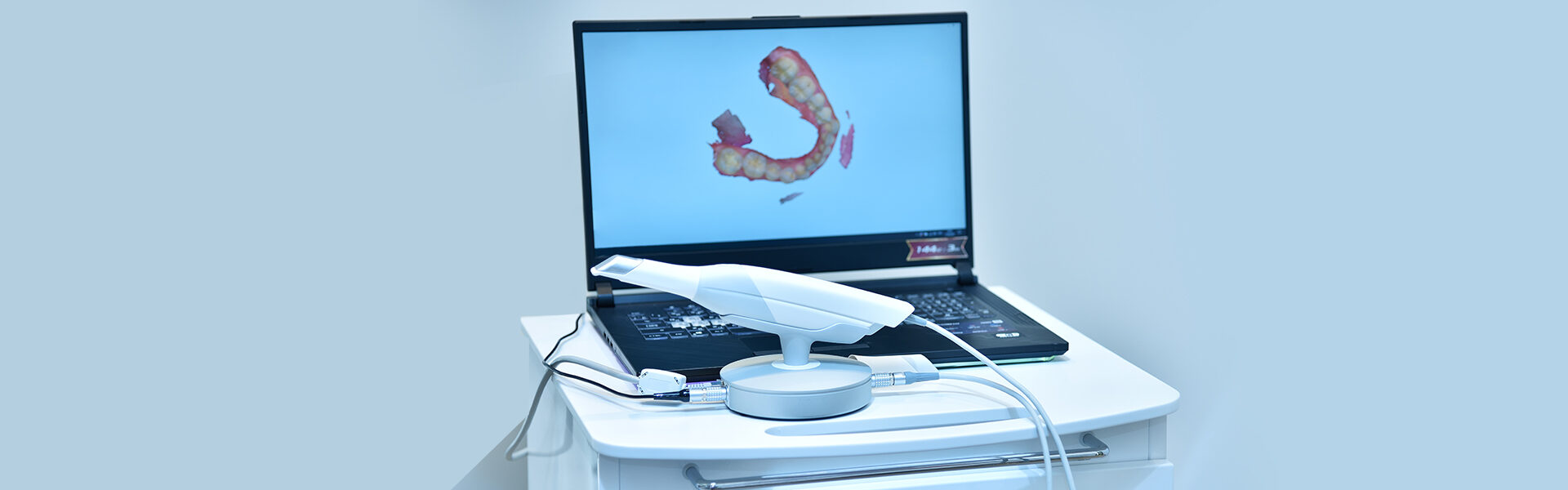 ITERO-Intraoral Scanner
